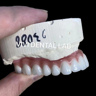 Naturalny wygląd estetyczny śruby utrzymane Zirconia Implant Korona długotrwała
