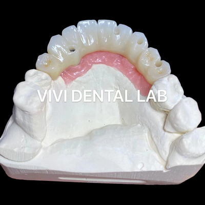 PMMA Precision Full Zirconia Bridge Over Multi Unit Abutments (dokładność PMMA pełny most z cyrkonu nad wielopłaszczyznami)