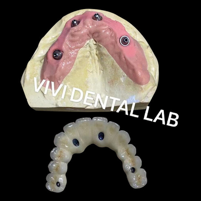 /Wszyscy na czworakach /Zirkoński most /Ivoclar Dental High Precision