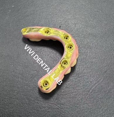 / Cały most z cyrkonia / z tytanową pręcią /