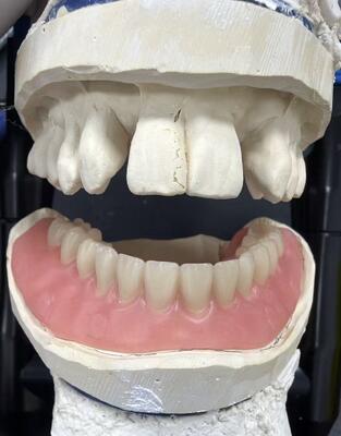 Laboratorium dentystyczne frezowane w Chinach