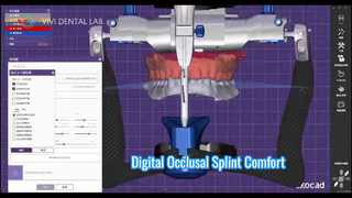 Cyfrowa szyna zgryzowa. Dokładny komfort