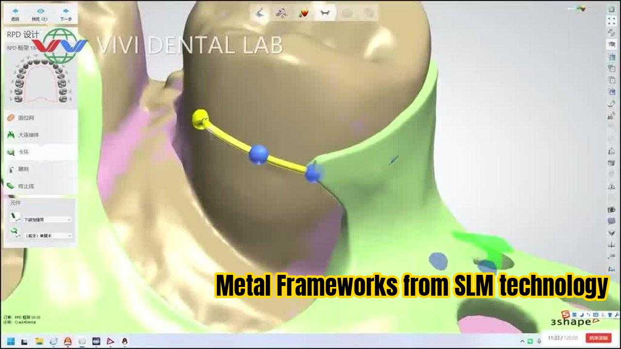 Chiny VIVI DENTAI LABORATORY Certyfikaty